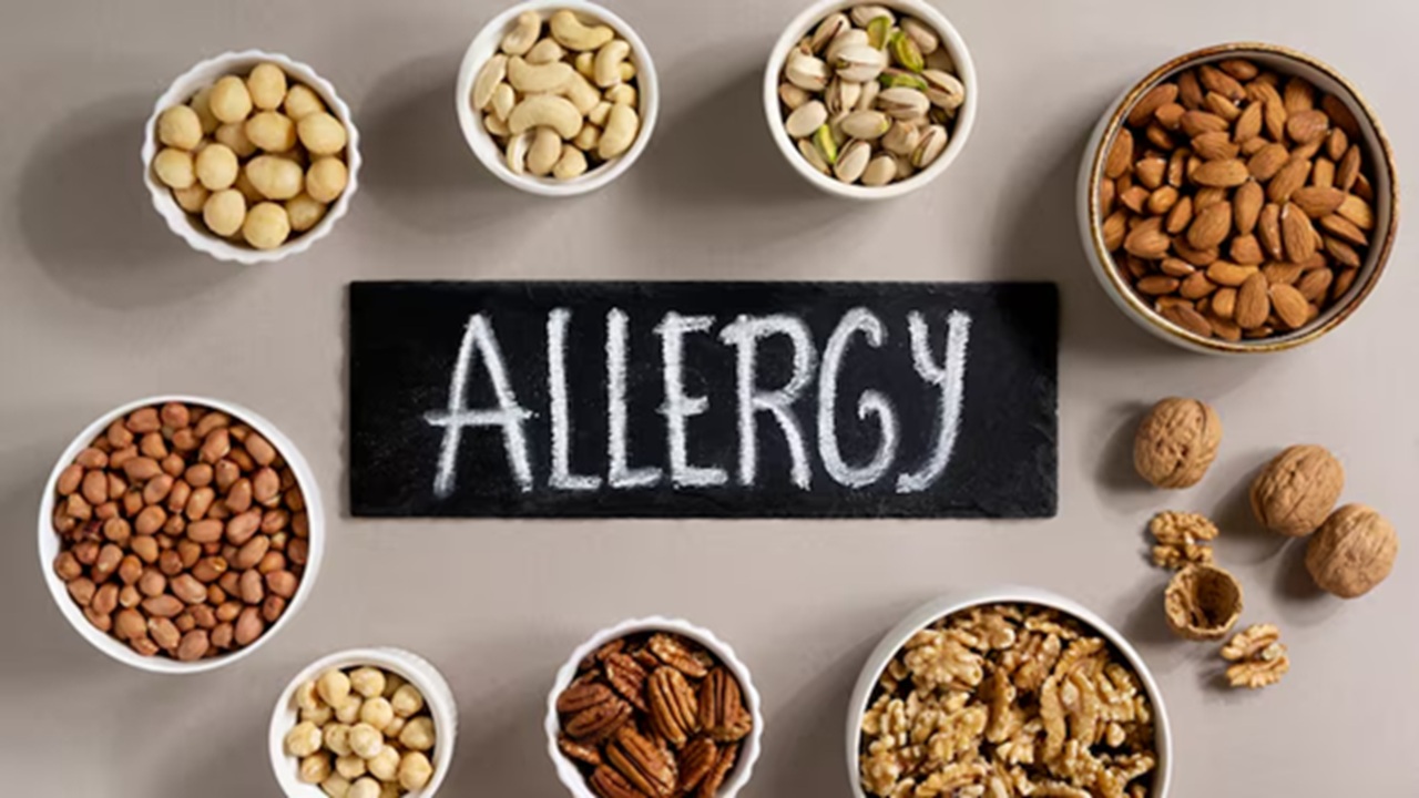 Health Tips: Most Common Food Allergies and Their Impact on Health